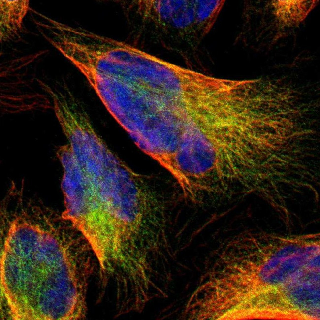 C1rLP Antibody in Immunocytochemistry (ICC/IF)