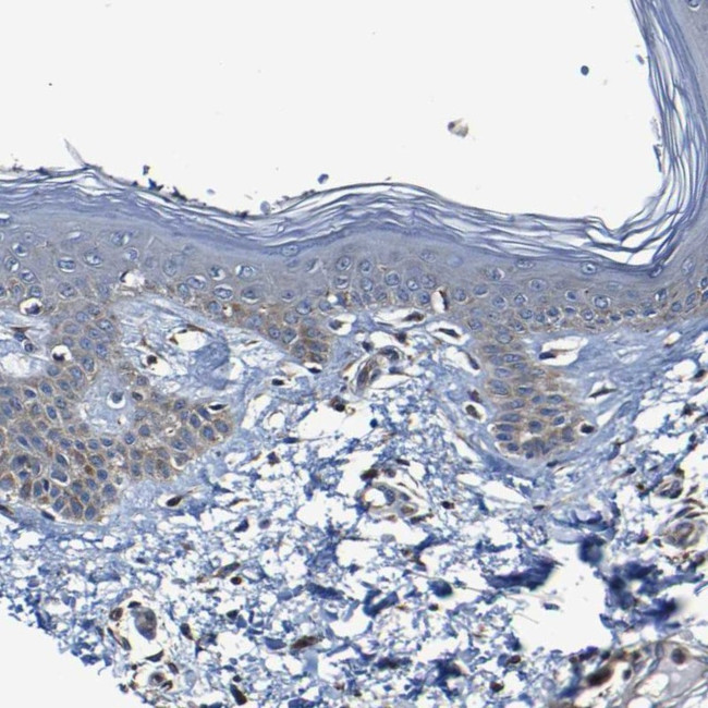ADAM15 Antibody in Immunohistochemistry (Paraffin) (IHC (P))