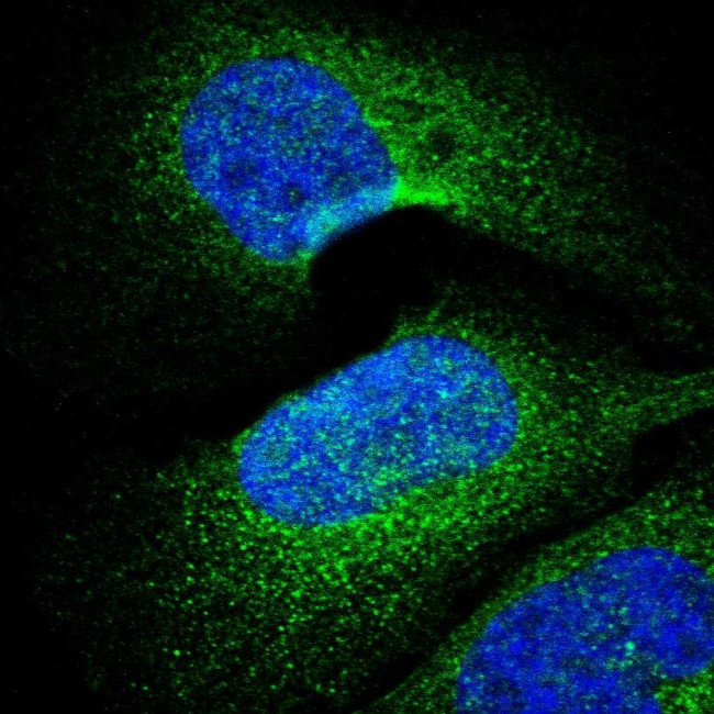 VPARP Antibody in Immunocytochemistry (ICC/IF)