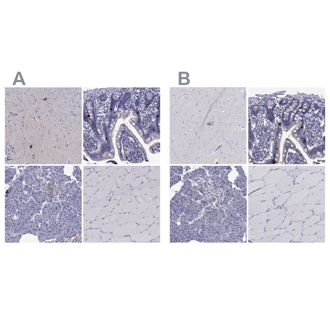 Chromogranin C Antibody in Immunohistochemistry (Paraffin) (IHC (P))