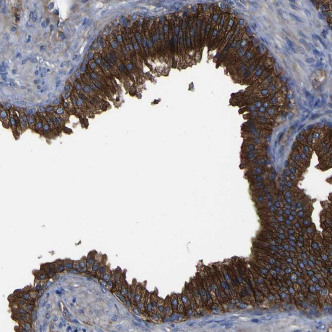 CD151 Antibody in Immunohistochemistry (Paraffin) (IHC (P))