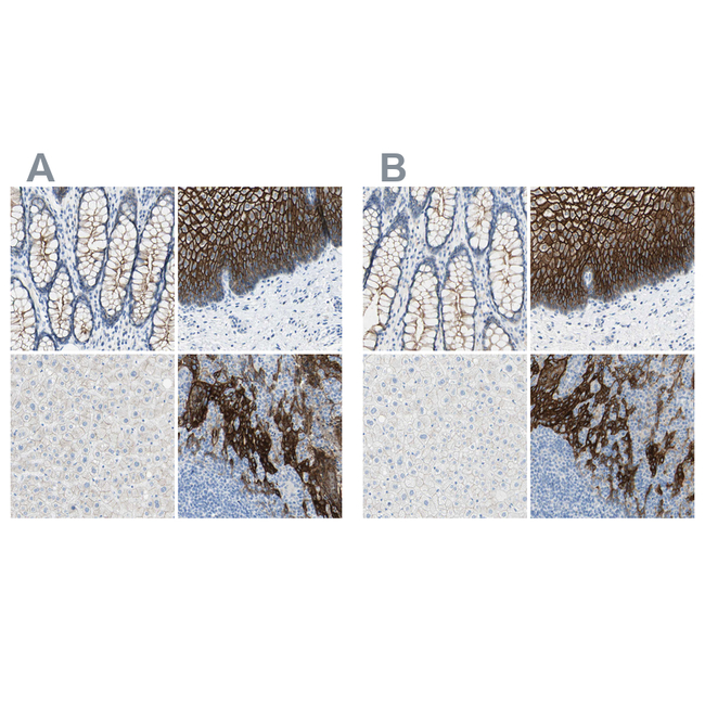Desmocollin 2 Antibody in Immunohistochemistry (Paraffin) (IHC (P))