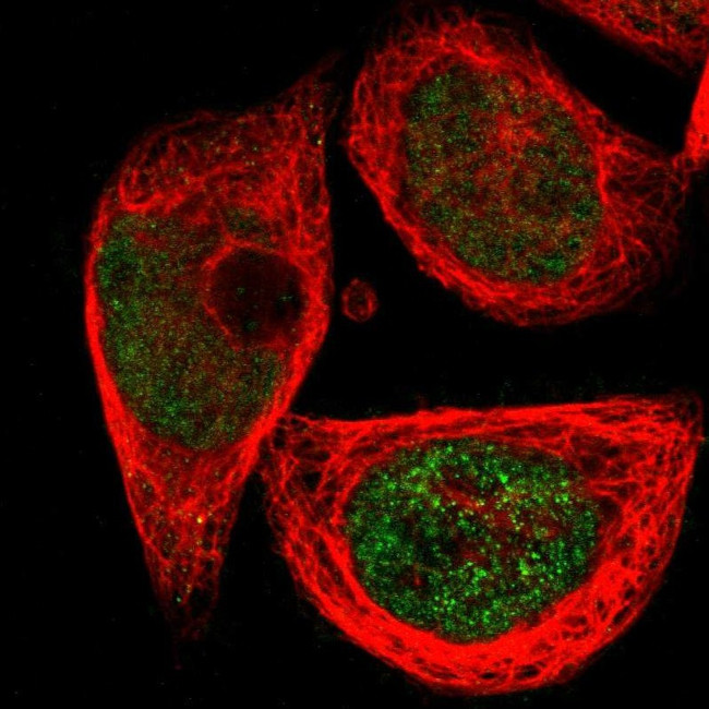 SGCG Antibody in Immunocytochemistry (ICC/IF)