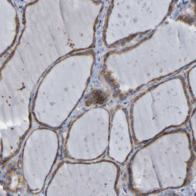 SIL1 Antibody in Immunohistochemistry (Paraffin) (IHC (P))