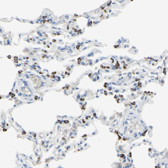 ACADL Antibody in Immunohistochemistry (Paraffin) (IHC (P))
