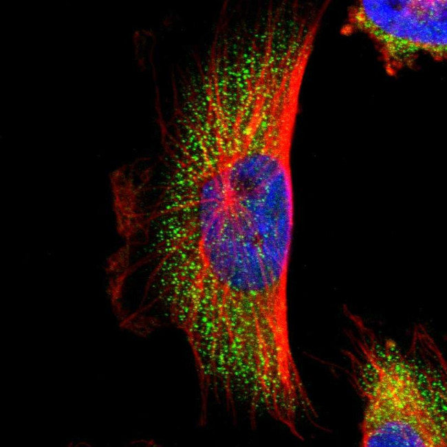 PARP14 Antibody in Immunocytochemistry (ICC/IF)
