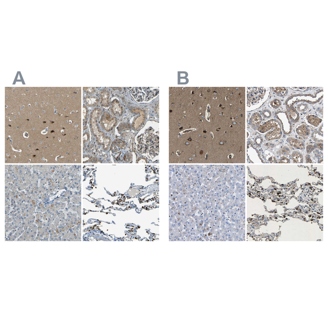 LPCAT1 Antibody in Immunohistochemistry (Paraffin) (IHC (P))
