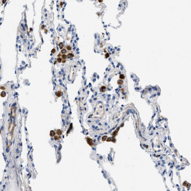 XCR1 Antibody in Immunohistochemistry (Paraffin) (IHC (P))