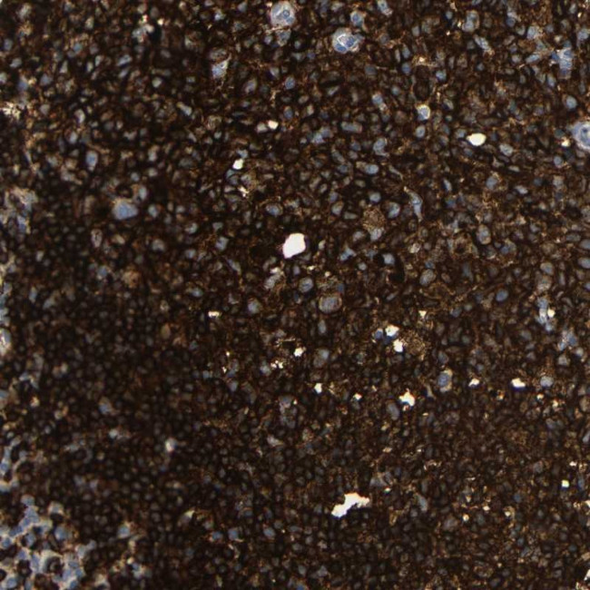 HLA-DQB1 Antibody in Immunohistochemistry (Paraffin) (IHC (P))