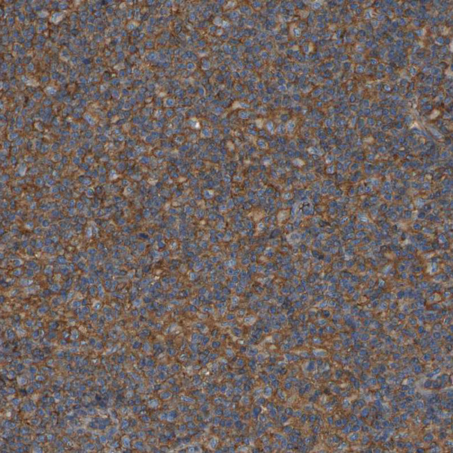 IQGAP1 Antibody in Immunohistochemistry (Paraffin) (IHC (P))