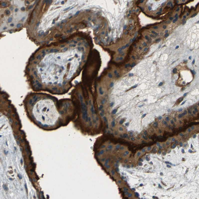 CD39 Antibody in Immunohistochemistry (Paraffin) (IHC (P))