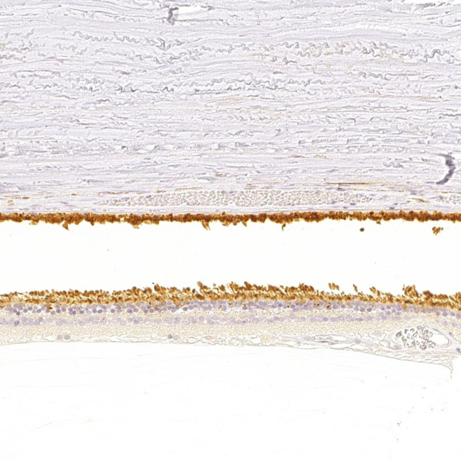 RGS9 Antibody in Immunohistochemistry (Paraffin) (IHC (P))
