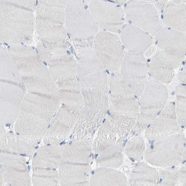 Kallikrein 5 Antibody in Immunohistochemistry (Paraffin) (IHC (P))