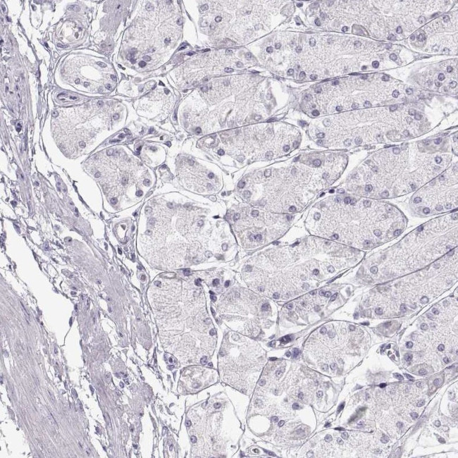 Allergin 1 Antibody in Immunohistochemistry (Paraffin) (IHC (P))