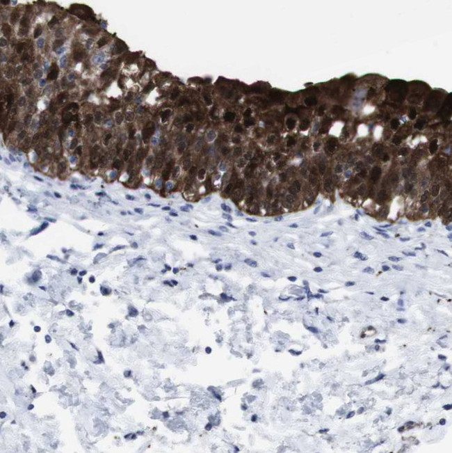 gamma Synuclein Antibody in Immunohistochemistry (Paraffin) (IHC (P))