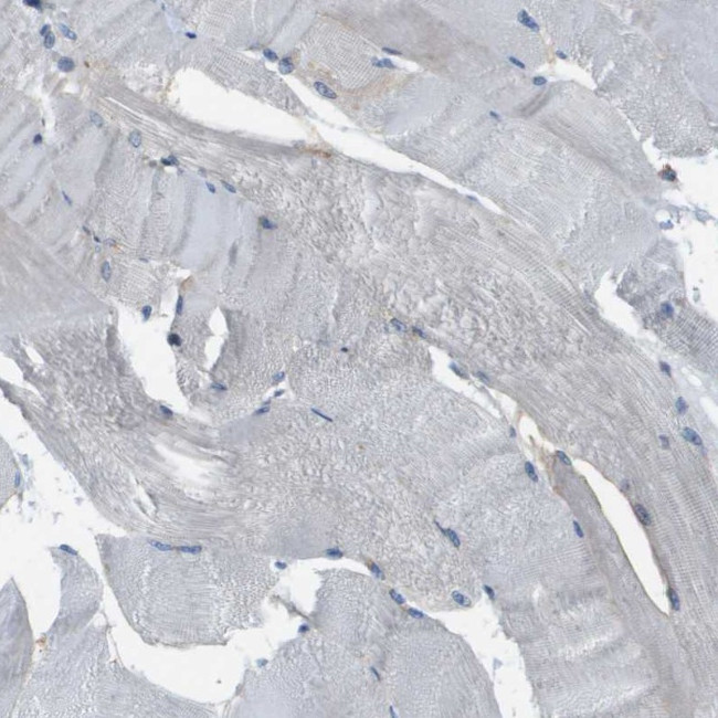 MYH11 Antibody in Immunohistochemistry (Paraffin) (IHC (P))