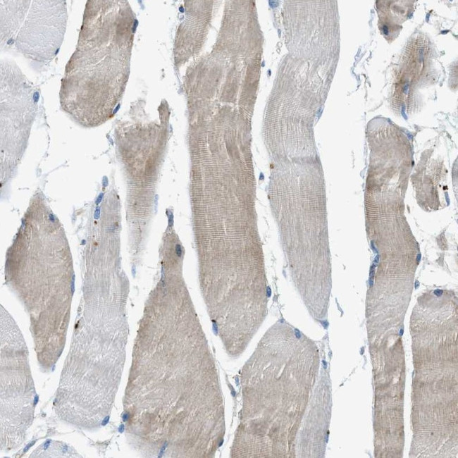 BMP1 Antibody in Immunohistochemistry (Paraffin) (IHC (P))