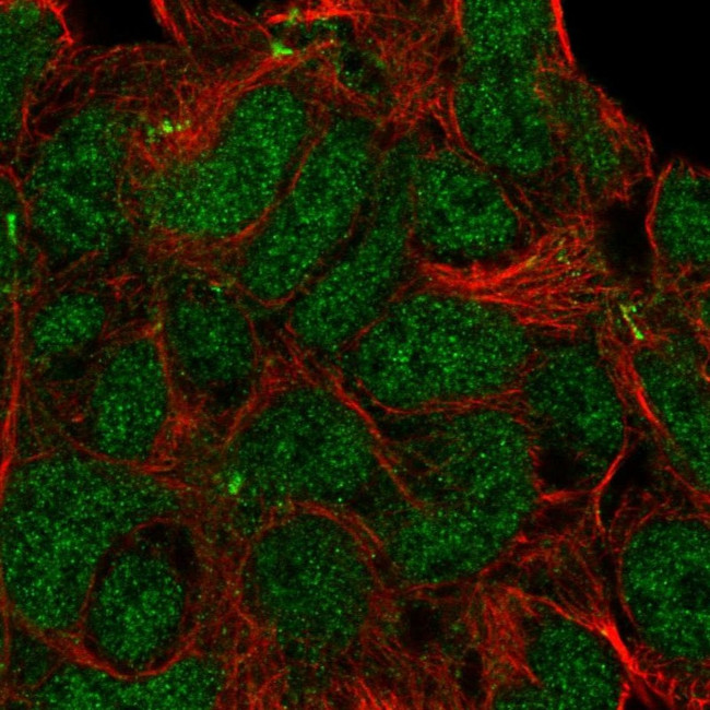 KIDINS220 Antibody in Immunocytochemistry (ICC/IF)