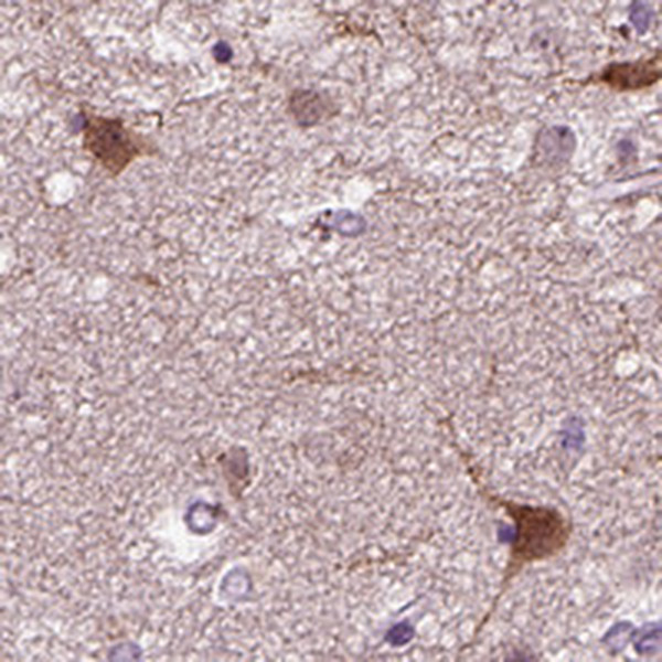 PRLH Antibody in Immunohistochemistry (Paraffin) (IHC (P))