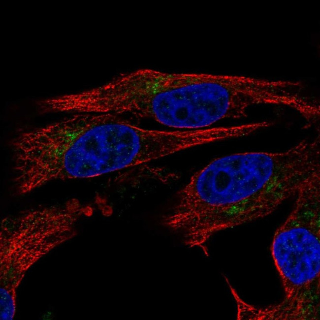 ENTPD6 Antibody in Immunocytochemistry (ICC/IF)