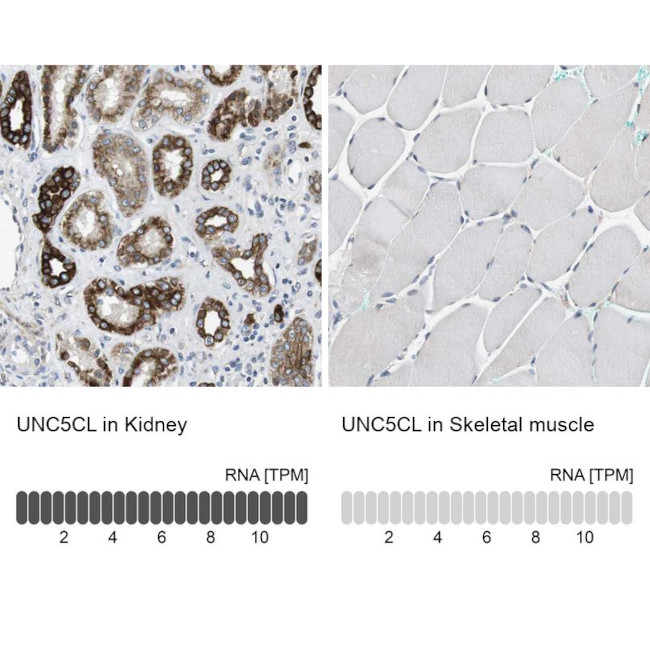 UNC5CL Antibody