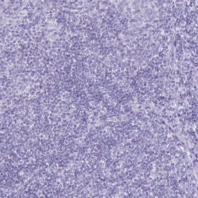 Defensin 5 Antibody in Immunohistochemistry (Paraffin) (IHC (P))