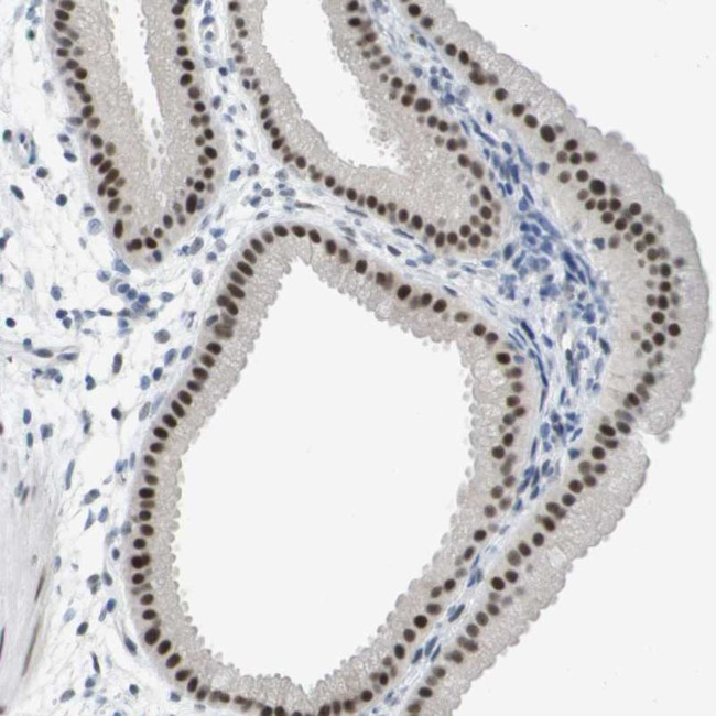 PRPK Antibody in Immunohistochemistry (Paraffin) (IHC (P))
