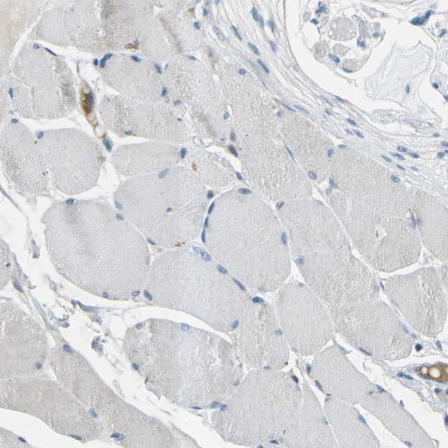 delta Catenin Antibody in Immunohistochemistry (Paraffin) (IHC (P))