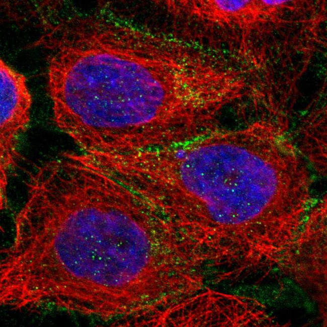delta Catenin Antibody in Immunocytochemistry (ICC/IF)