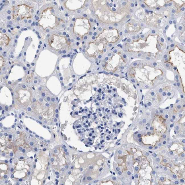 DARC Antibody in Immunohistochemistry (Paraffin) (IHC (P))