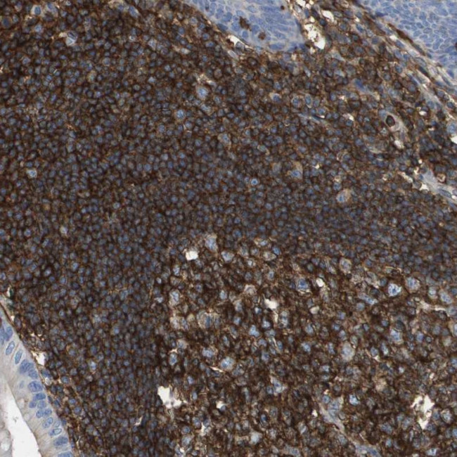 PASK Antibody in Immunohistochemistry (Paraffin) (IHC (P))