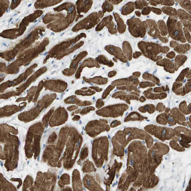 MYL3 Antibody in Immunohistochemistry (Paraffin) (IHC (P))