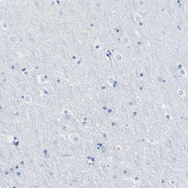 TCL1A Antibody in Immunohistochemistry (Paraffin) (IHC (P))