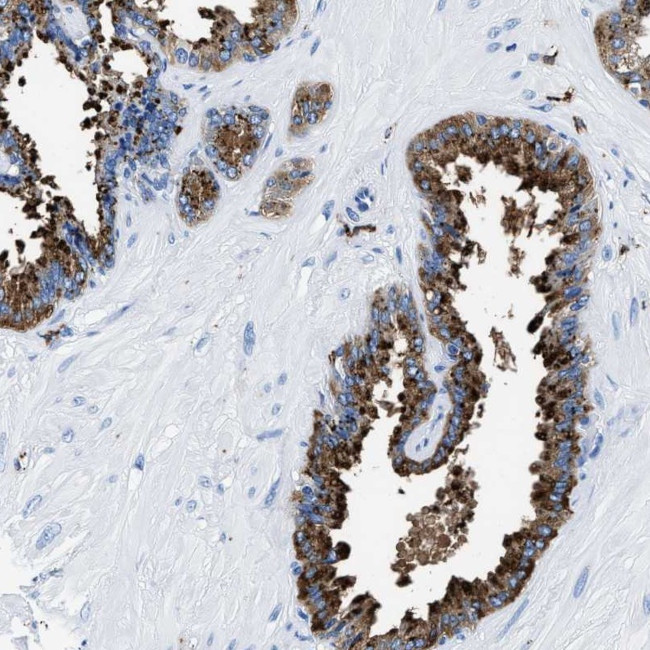 OR14K1 Antibody in Immunohistochemistry (Paraffin) (IHC (P))