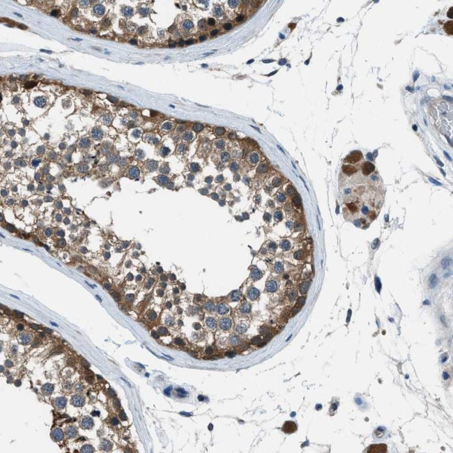 Acid Phosphatase 1 Antibody in Immunohistochemistry (Paraffin) (IHC (P))