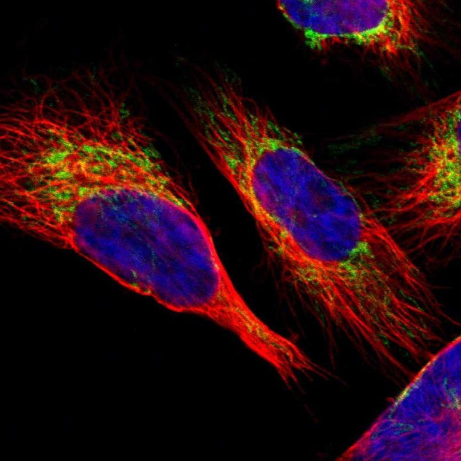 SLC25A31 Antibody in Immunocytochemistry (ICC/IF)