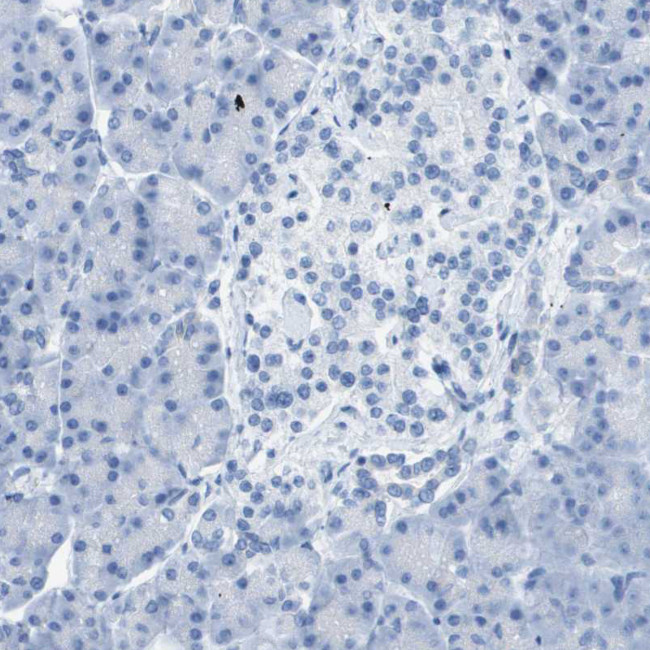 CD46 Antibody in Immunohistochemistry (Paraffin) (IHC (P))