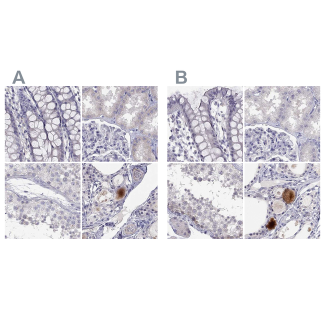 C16orf89 Antibody in Immunohistochemistry (Paraffin) (IHC (P))