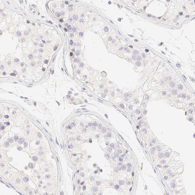 PADI4 Antibody in Immunohistochemistry (Paraffin) (IHC (P))