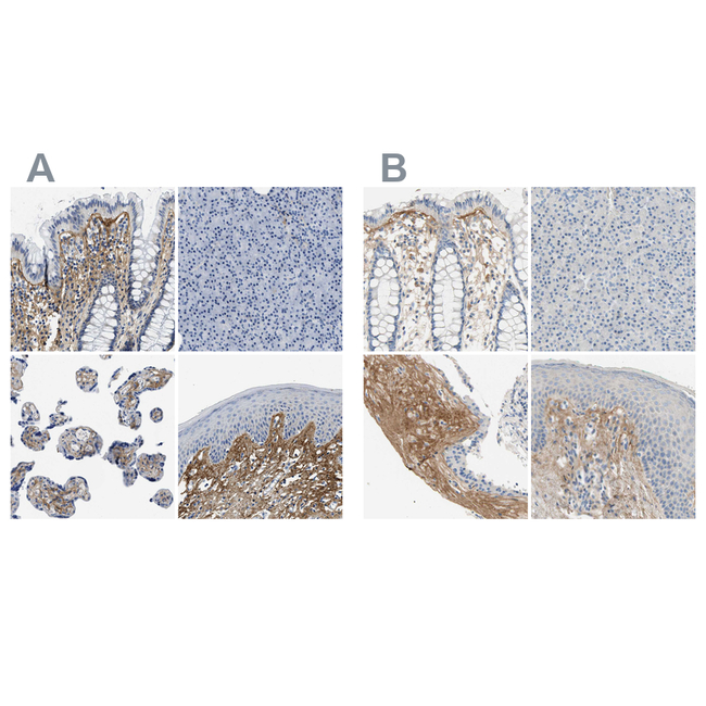 TGFBI Antibody in Immunohistochemistry (Paraffin) (IHC (P))