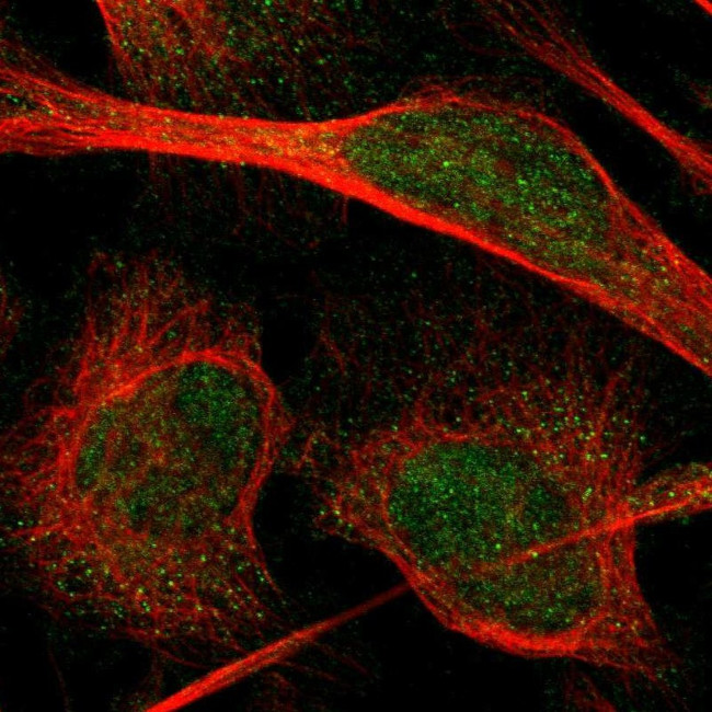PIP5K1C Antibody in Immunocytochemistry (ICC/IF)