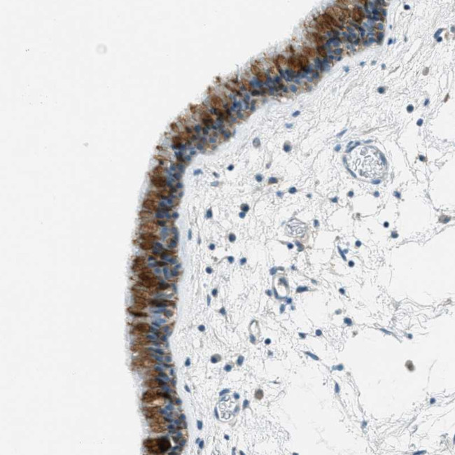 Mesothelin Antibody in Immunohistochemistry (Paraffin) (IHC (P))