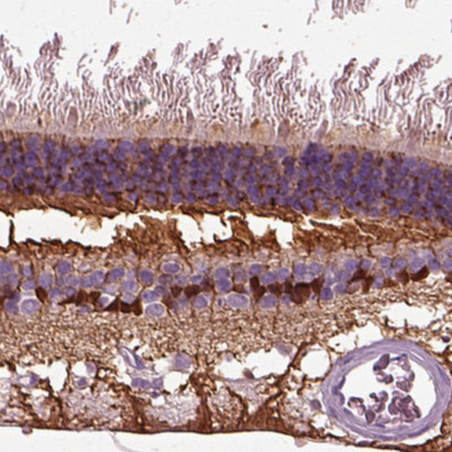 CRABP1 Antibody in Immunohistochemistry (Paraffin) (IHC (P))