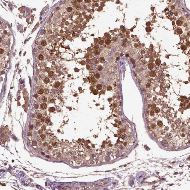 ERV3 Antibody in Immunohistochemistry (Paraffin) (IHC (P))
