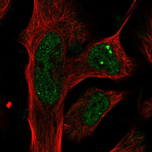 PLXDC2 Antibody in Immunocytochemistry (ICC/IF)