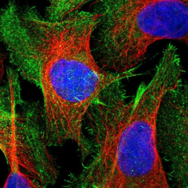 Caldesmon Antibody in Immunocytochemistry (ICC/IF)