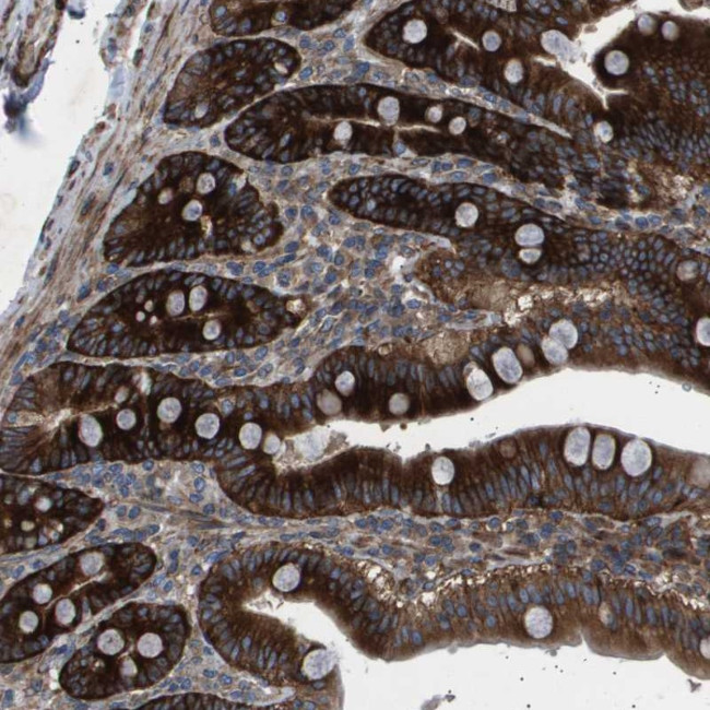 OR51J1 Antibody in Immunohistochemistry (Paraffin) (IHC (P))