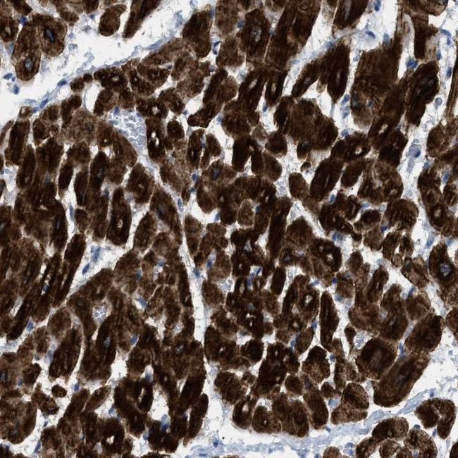 ICA1 Antibody in Immunohistochemistry (Paraffin) (IHC (P))