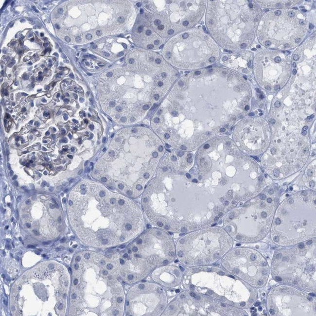 DARC Antibody in Immunohistochemistry (Paraffin) (IHC (P))