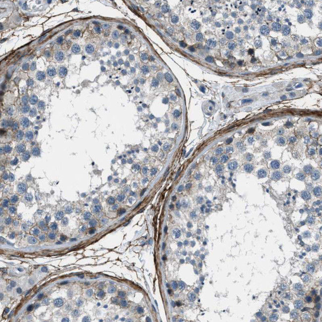Fibrillin 1 Antibody in Immunohistochemistry (Paraffin) (IHC (P))